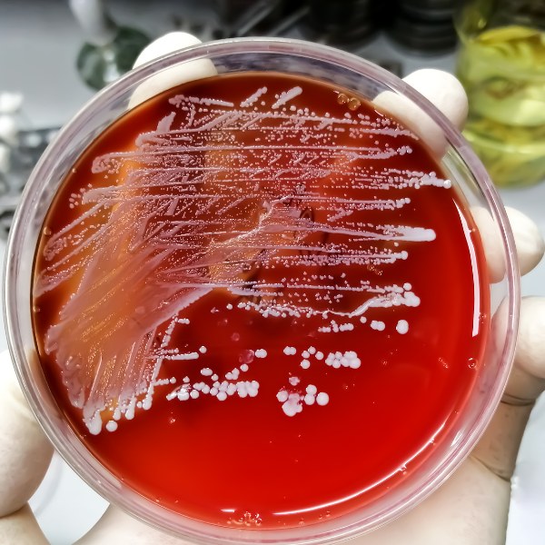 Staphylococcus aureus enterotoxin