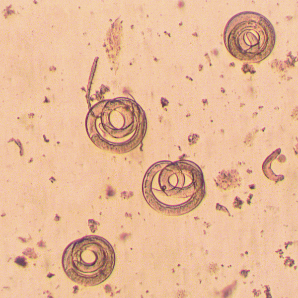 Trichinella spiralis